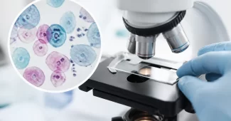 Ankstyvoji diagnostika gimdos kaklelio vėžio riziką sumažina iki 90%