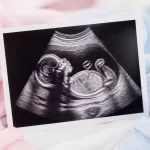 Kaip užprogramuoti kūdikio lytį